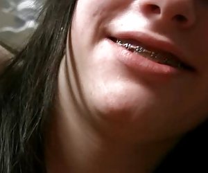 年轻的青少年的牙套